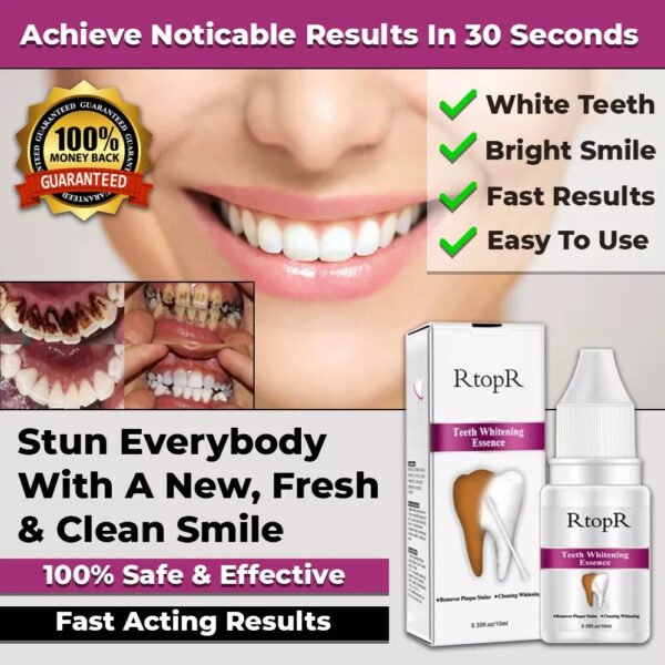 NEW INSTANT TOOTH WHITENING KIT WHITE TEETH CLEAN GEL UV BLEACH DENTAL STRENGTH