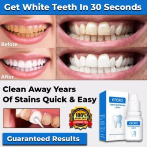 NEW INSTANT TOOTH WHITENING KIT WHITE TEETH CLEAN GEL UV BLEACH DENTAL STRENGTH