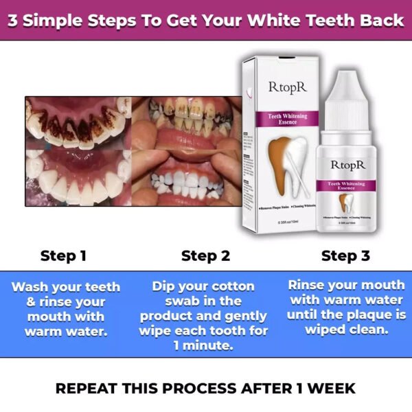 NEW INSTANT TOOTH WHITENING KIT WHITE TEETH CLEAN GEL UV BLEACH DENTAL STRENGTH - Image 3