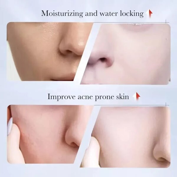 Kojie Face Lightening Cream 50g Skin Whitening Brightening Kojic Acid Dark Spots - Image 4