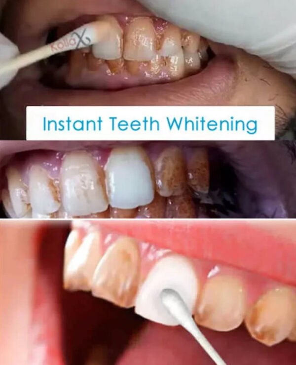 NEW INSTANT TOOTH WHITENING KIT WHITE TEETH CLEAN GEL UV BLEACH DENTAL STRENGTH - Image 6
