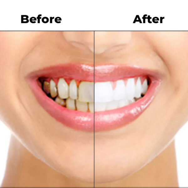 NEW INSTANT TOOTH WHITENING KIT WHITE TEETH CLEAN GEL UV BLEACH DENTAL STRENGTH - Image 9
